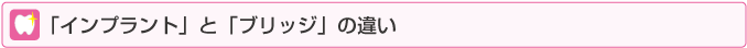 「インプラント」と「ブリッジ」の違い