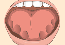舌の側面に歯型がついてギザギザになっているイメージ